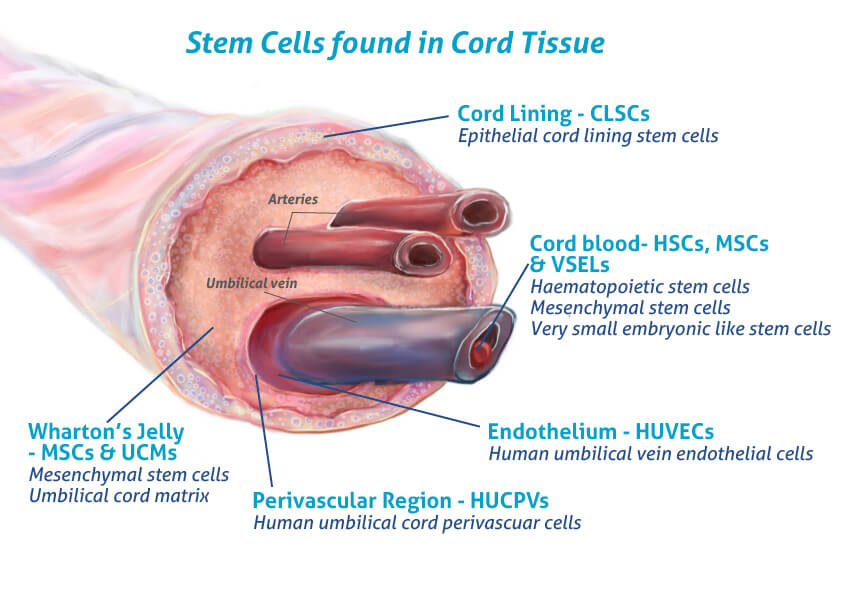 Umbilical Cord Tissue Stem Cells Why You Should Store