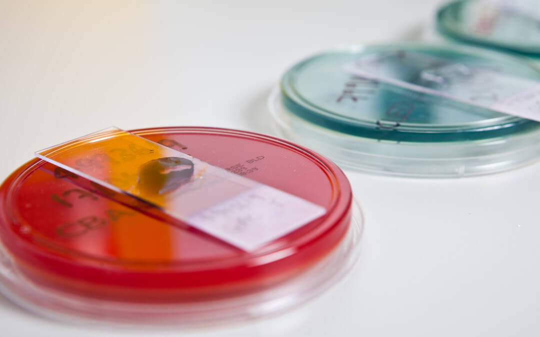 Variety of petri dish