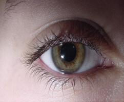 Stem cell eye treatment gives sight back