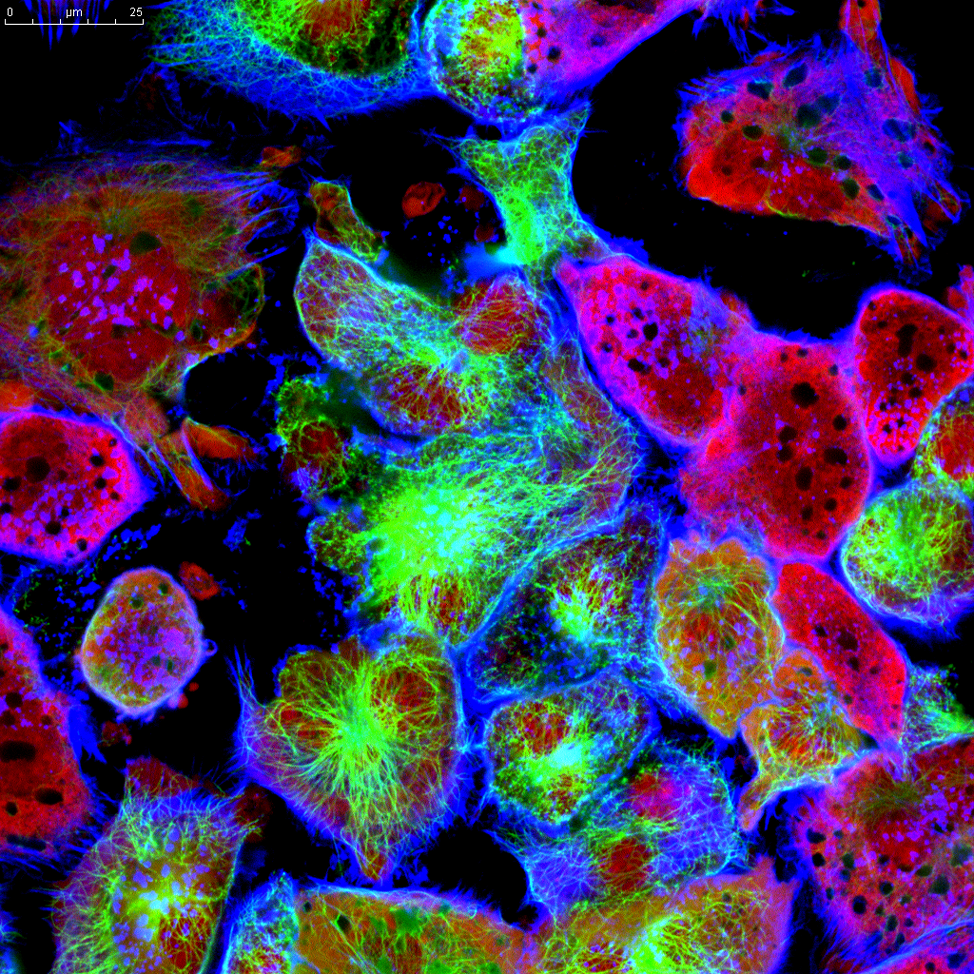 Neuroblastoma and Stem Cells