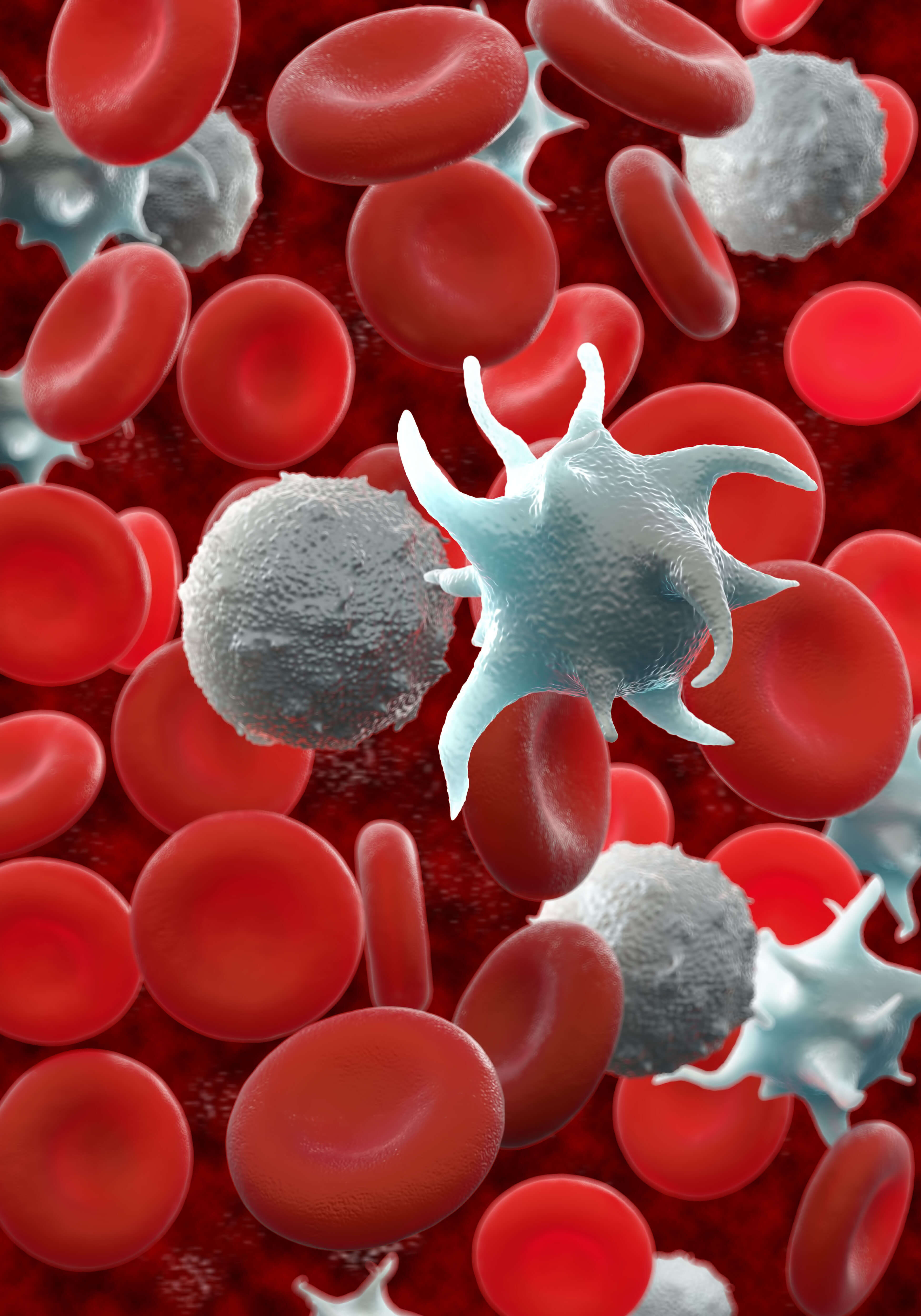 Leukaemia