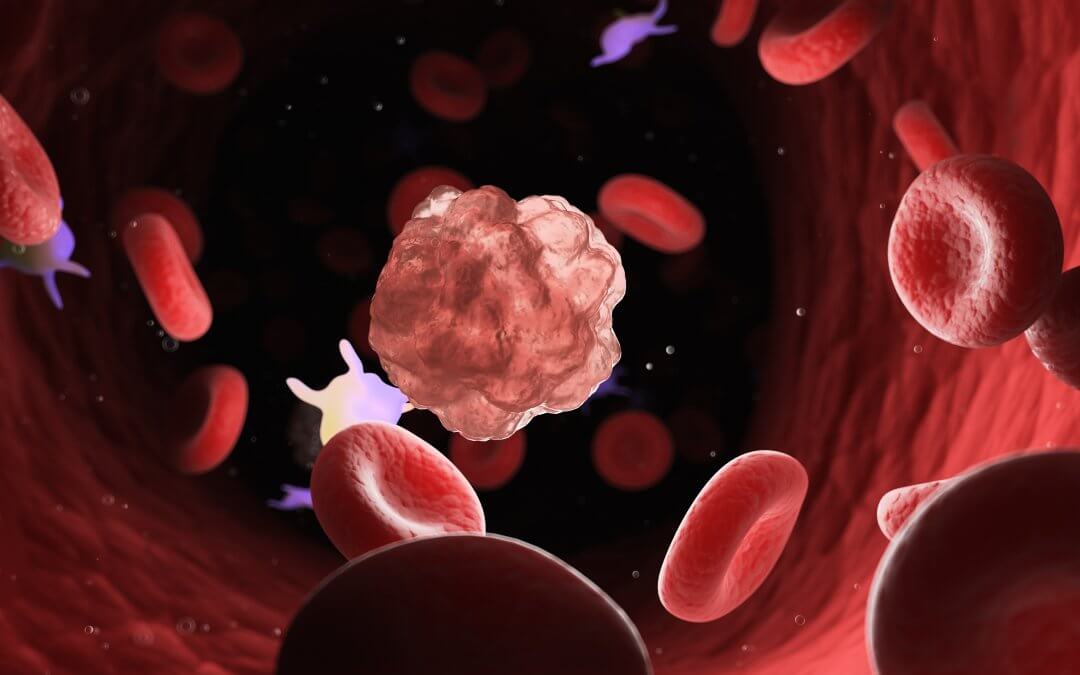 gene therapy for leukaemia
