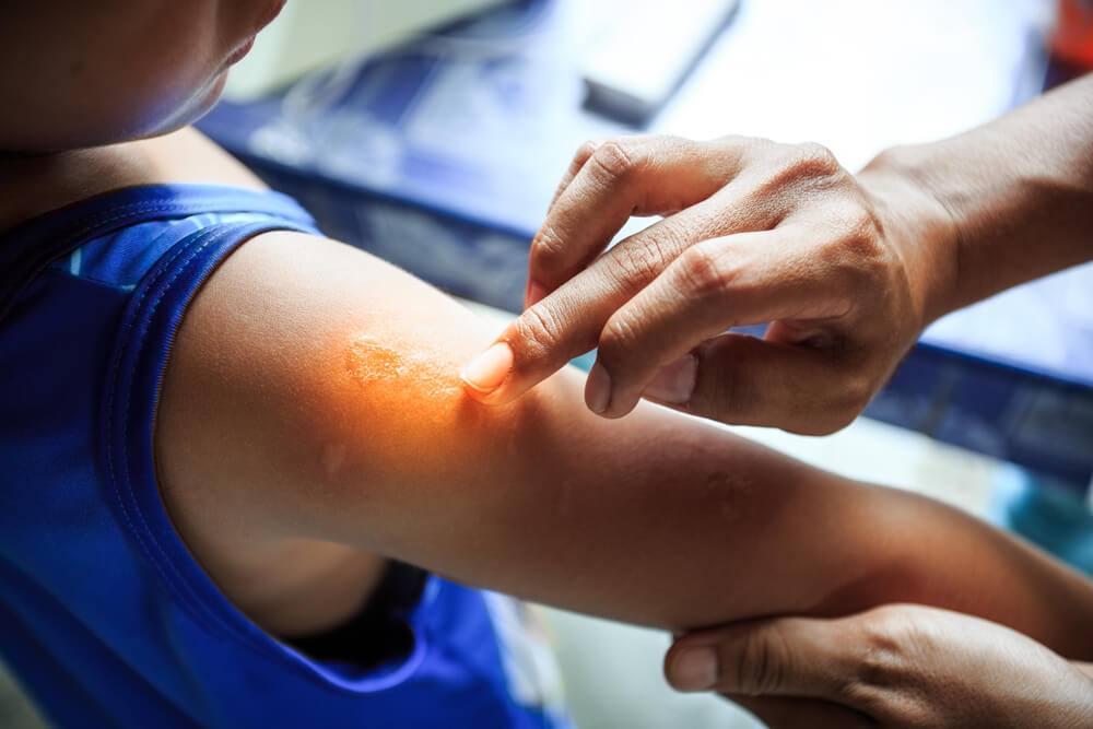 Doctor treating a boy with eczema