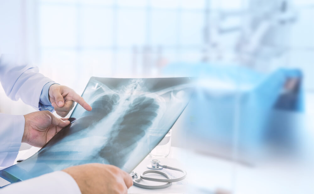 Chest X-Ray