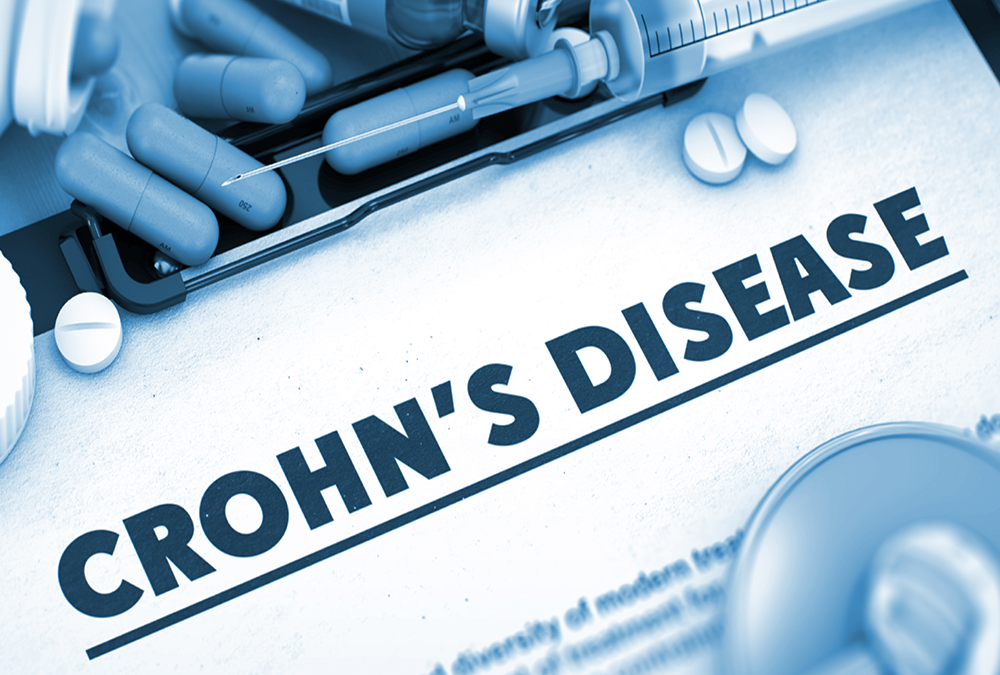 Stem Cells: A Potential Breakthrough in Crohn’s Disease Treatment?