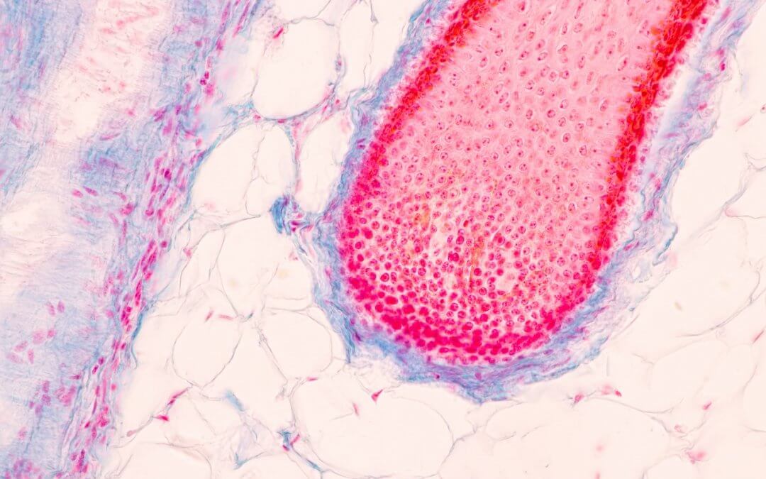 scalp and hair follicles under a microscope