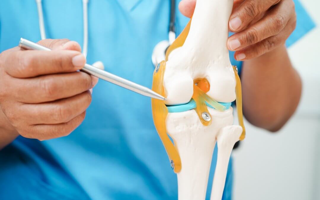 Doctor explaining knee osteoarthritis therapy