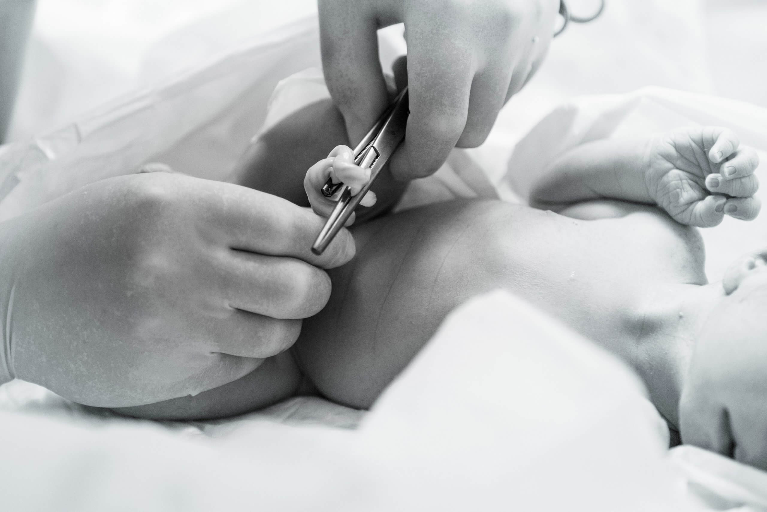 Doctor clamping baby's umbilical cord, delayed cord clamping