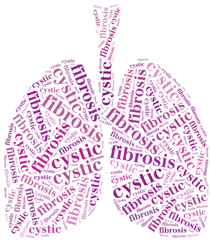 Cystic Fibrosis and Stem Cells