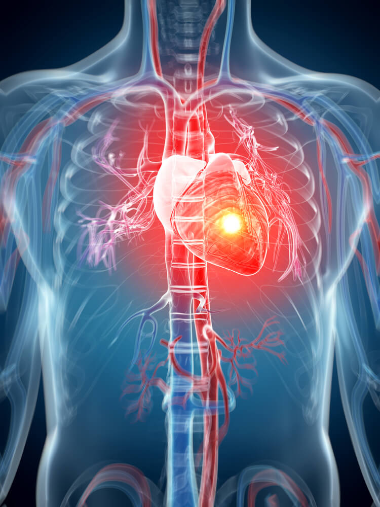 Umbilical cord stem cells repair heart disease