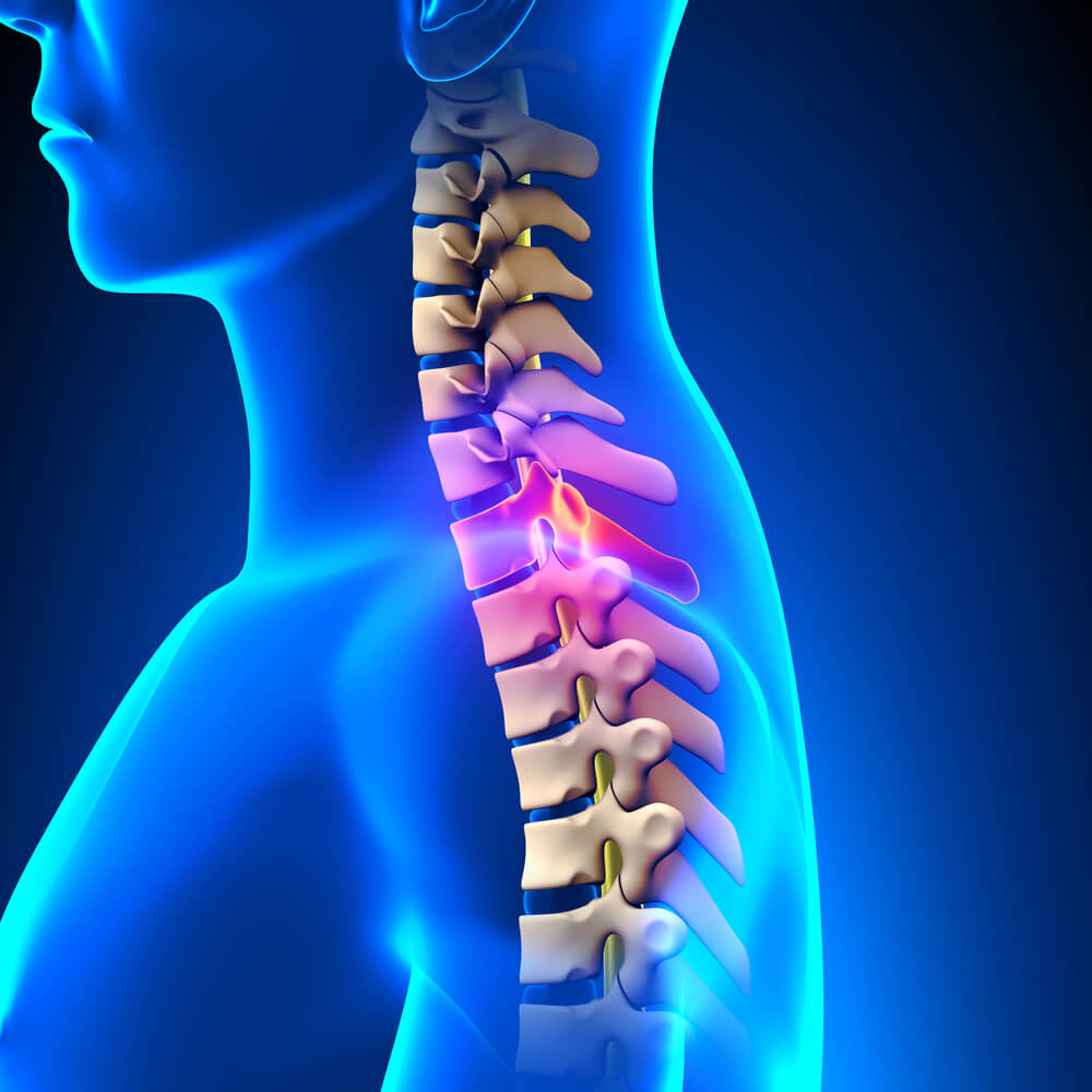 Define The Term Spinal Cord Injury