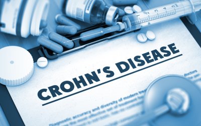 UK based clinical trial to treat Crohn’s with stem cells