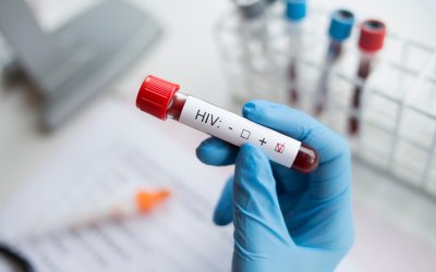 Second HIV patient cured with stem cell treatment