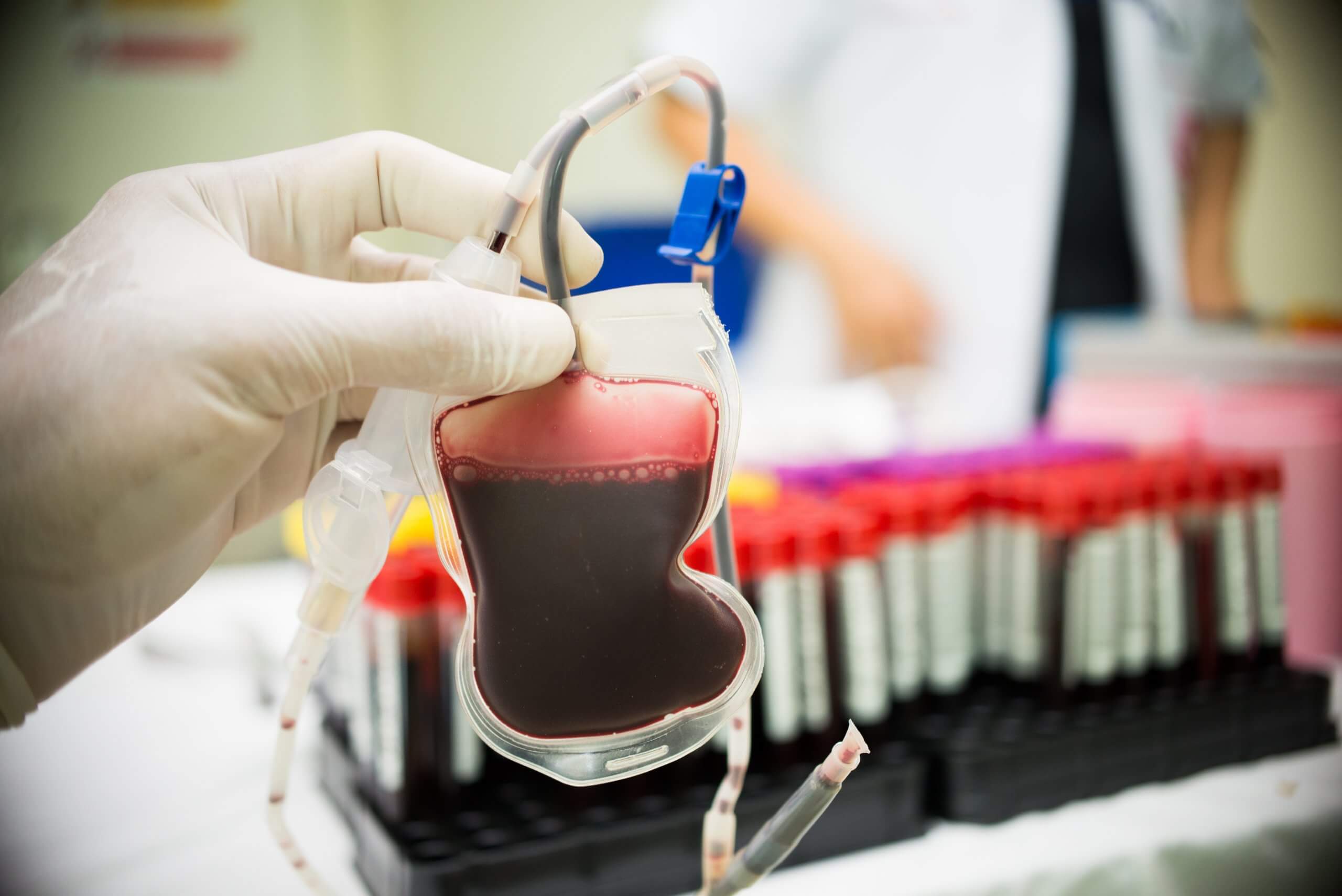 New study suggests umbilical cord blood stem cells implanted into COVID-19  patients could improve chances of survival | Cells4Life