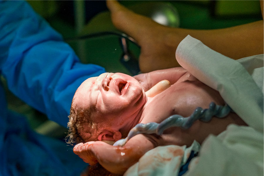 New Born Baby Feet And Umbilical Cord Stock Photo - Download Image Now -  Umbilical Cord, Blood, Stem Cell - iStock