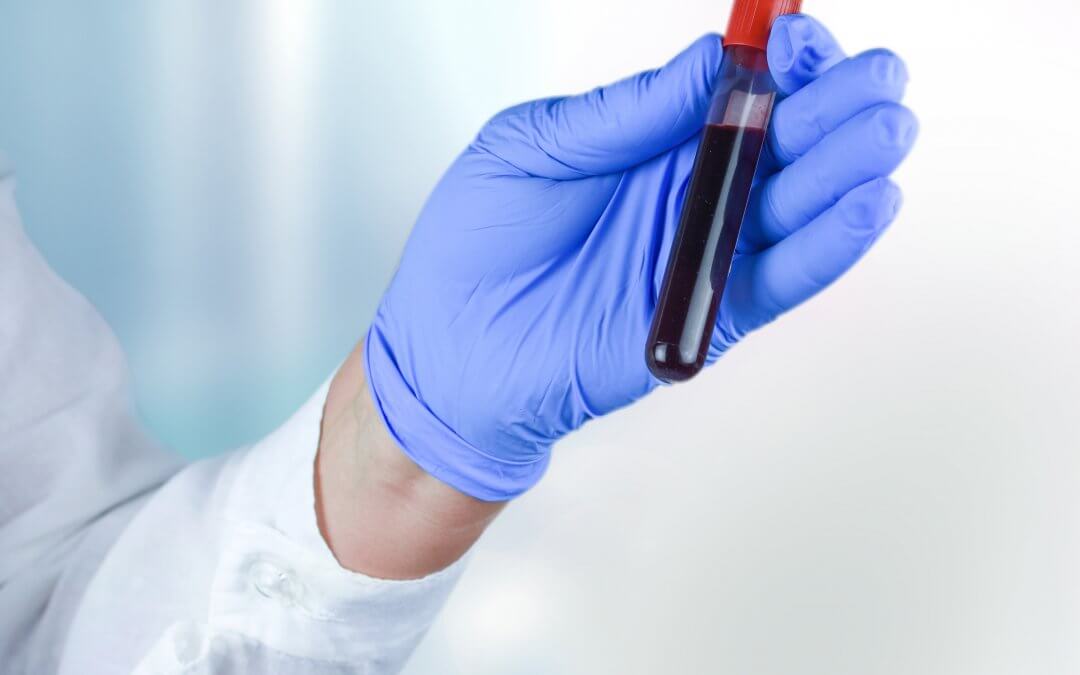 Doctor holding vial of blood