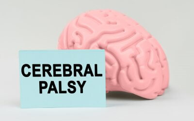 Evidence Supports Cord Blood Therapy for Cerebral Palsy