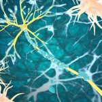 Illustration of nerves damaged by multiple sclerosis