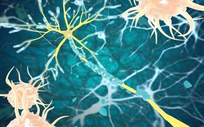 Early Insights Into Placenta Stem Cell Therapy for Multiple Sclerosis