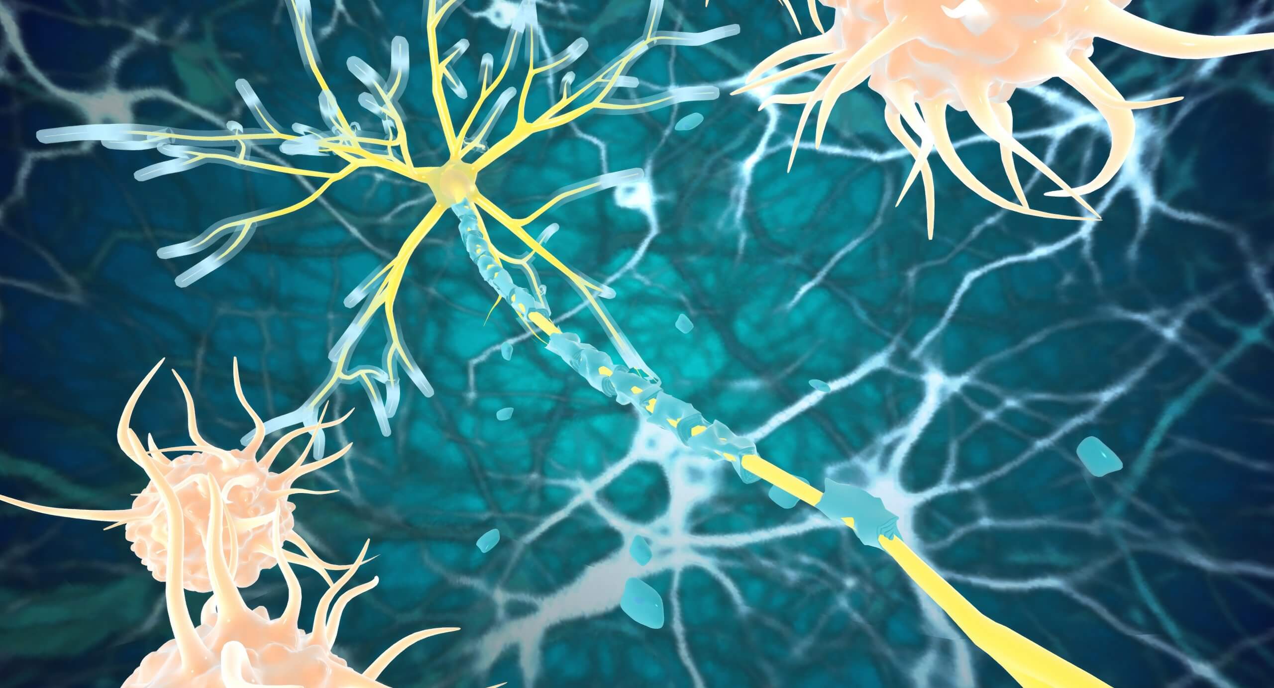 Illustration of nerves damaged by multiple sclerosis