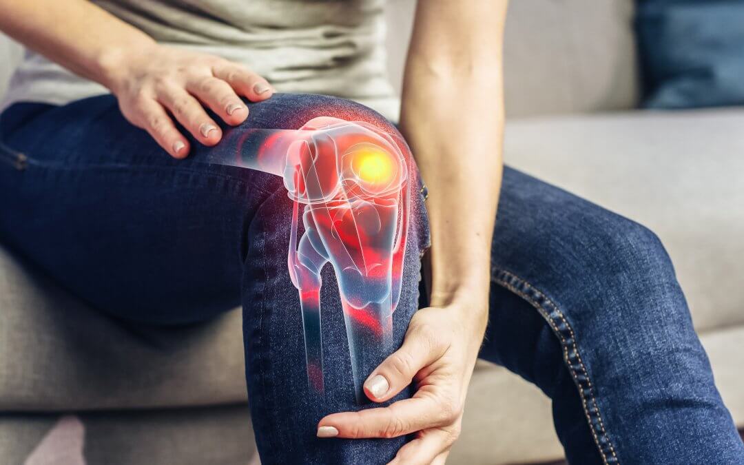 Illustration of knee osteoarthritis