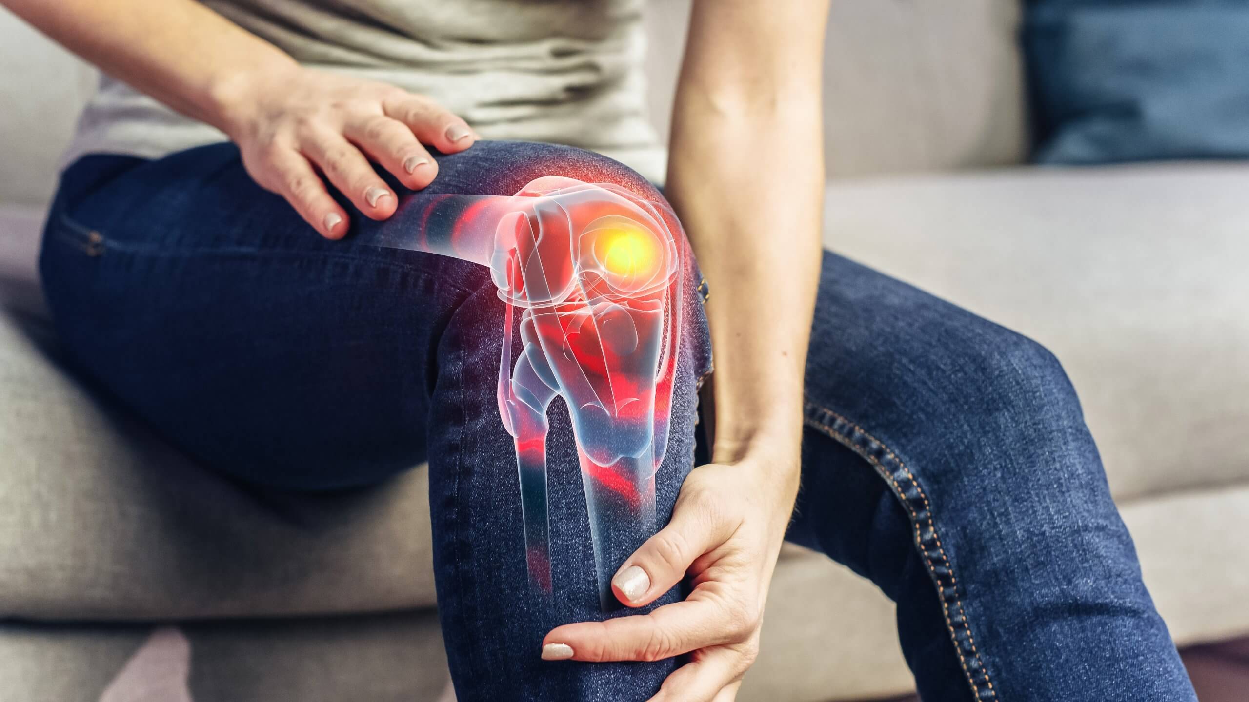 Illustration of knee osteoarthritis