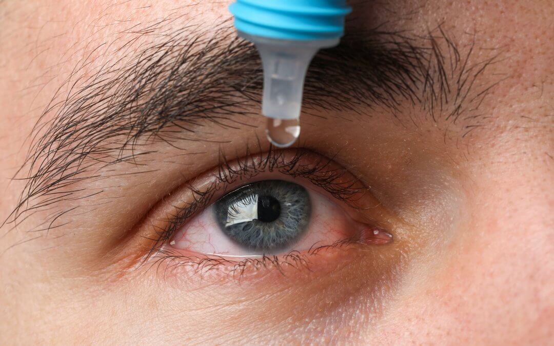 Umbilical Cord Stem Cell Eye Drops Could Offer Relief From Dry Eye