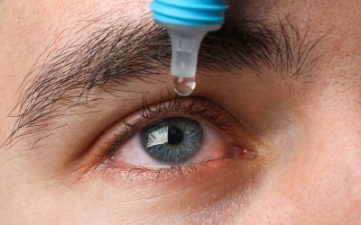 Umbilical Cord Stem Cell Eye Drops Could Offer Relief From Dry Eye