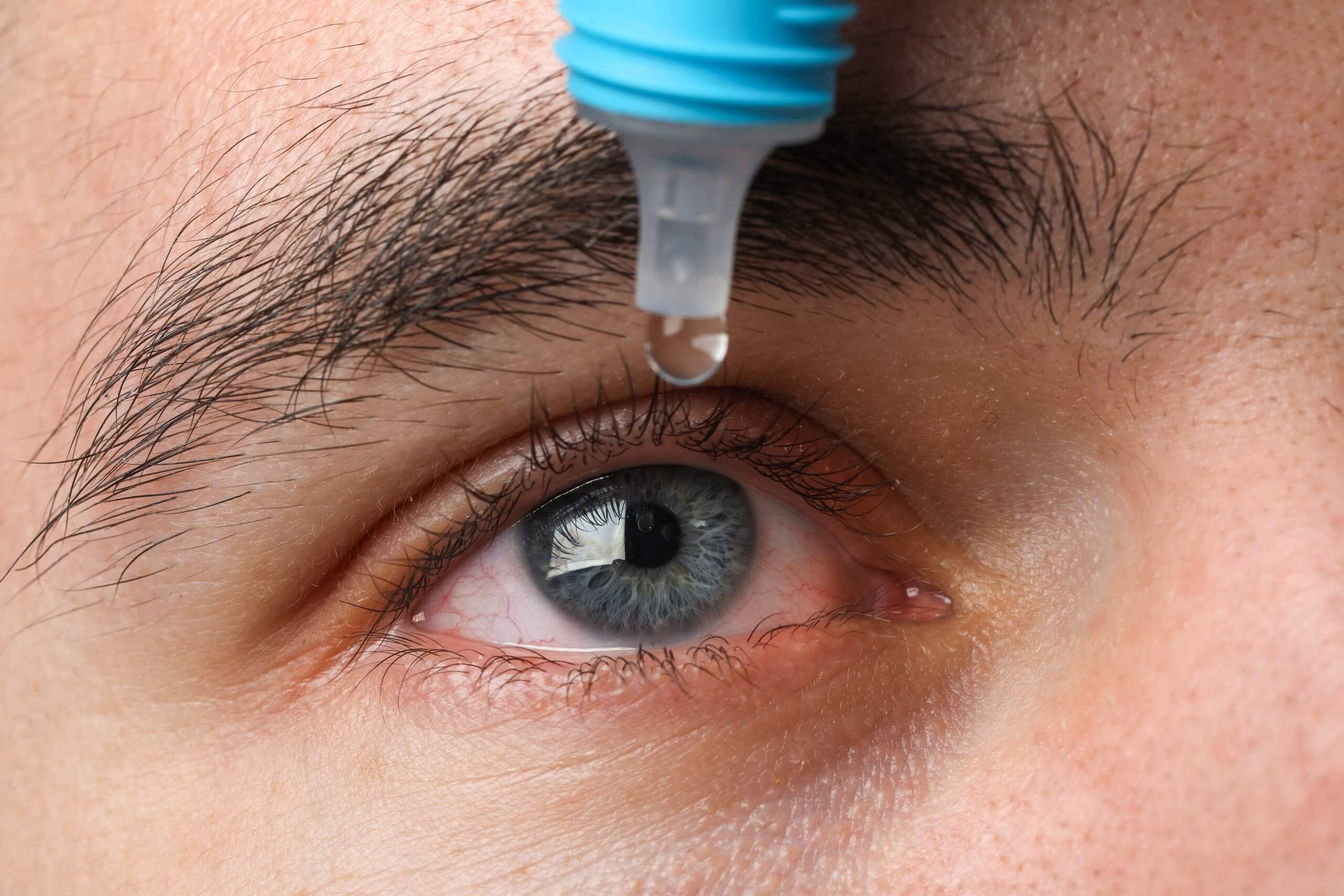 Stem cell eye drops for dry eye