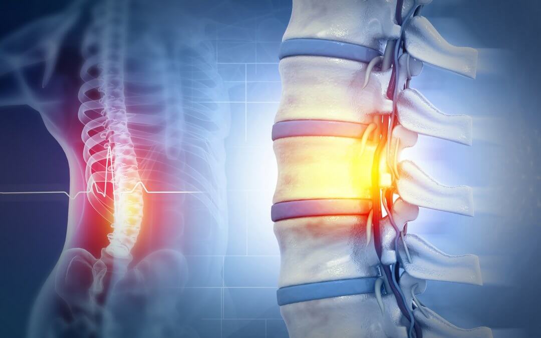 Wharton’s Jelly Stem Cells Show Promise for Chronic Spinal Cord Injury in New Study