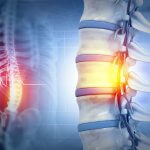 Wharton’s Jelly Stem Cells Show Promise for Chronic Spinal Cord Injury in New Study