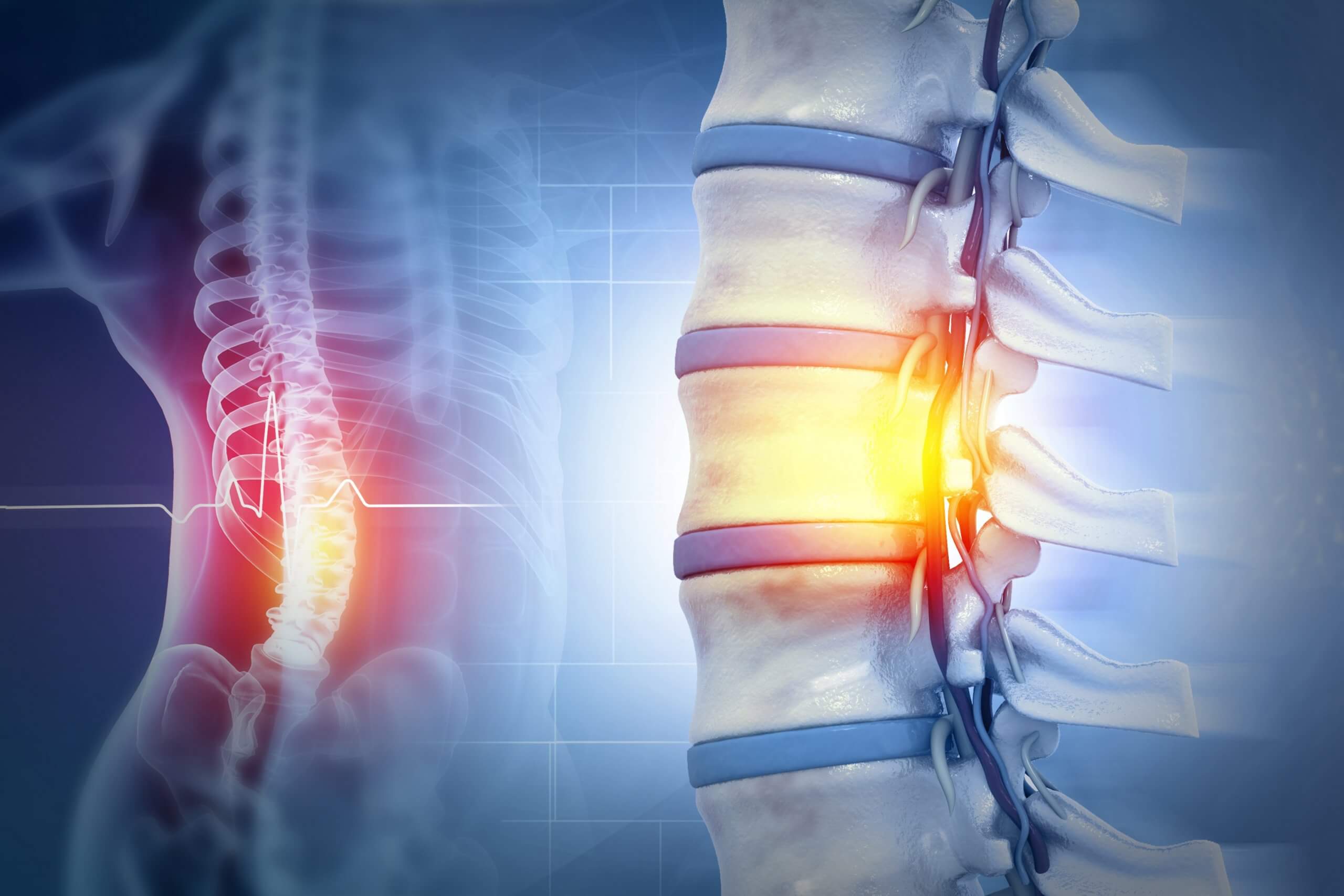 Wharton’s Jelly Stem Cells Show Promise for Chronic Spinal Cord Injury in New Study