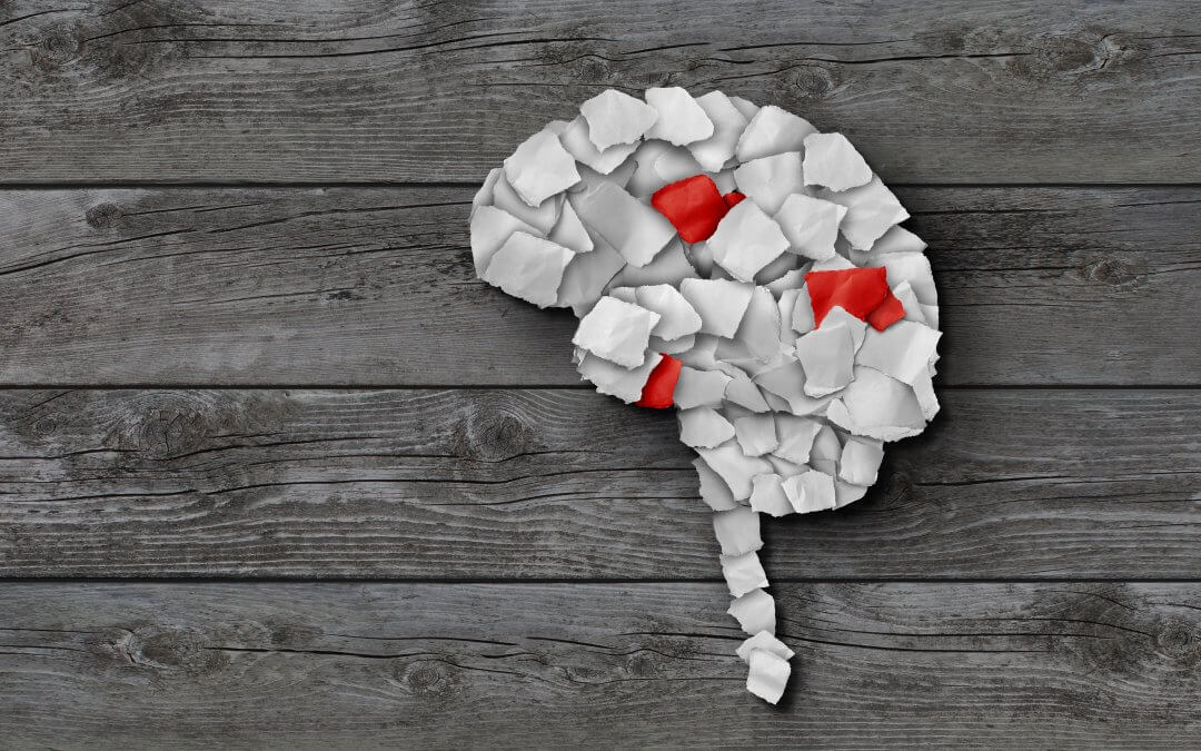 Illustration of brain cancer