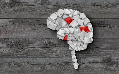 Novel Cell Therapy Helps Woman Beat Brain Cancer