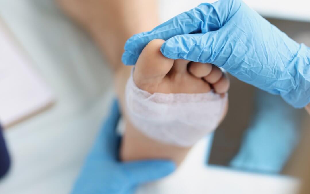 Close up of a bandaged foot being examined by a doctor.